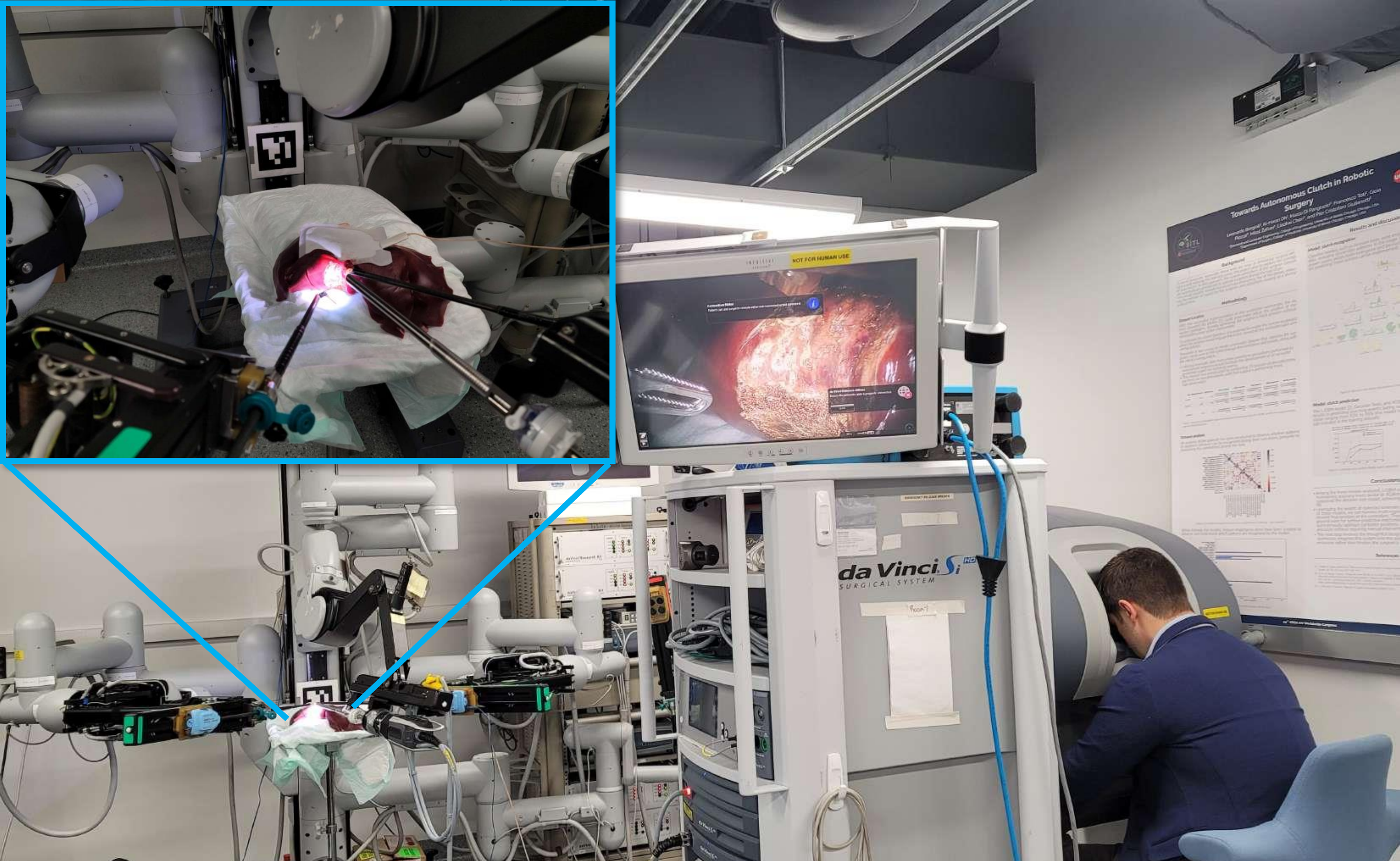 The recording setup and a montage of stereo endoscope frames, robot kinematics, and pedal signals that make up the CRCD dataset.